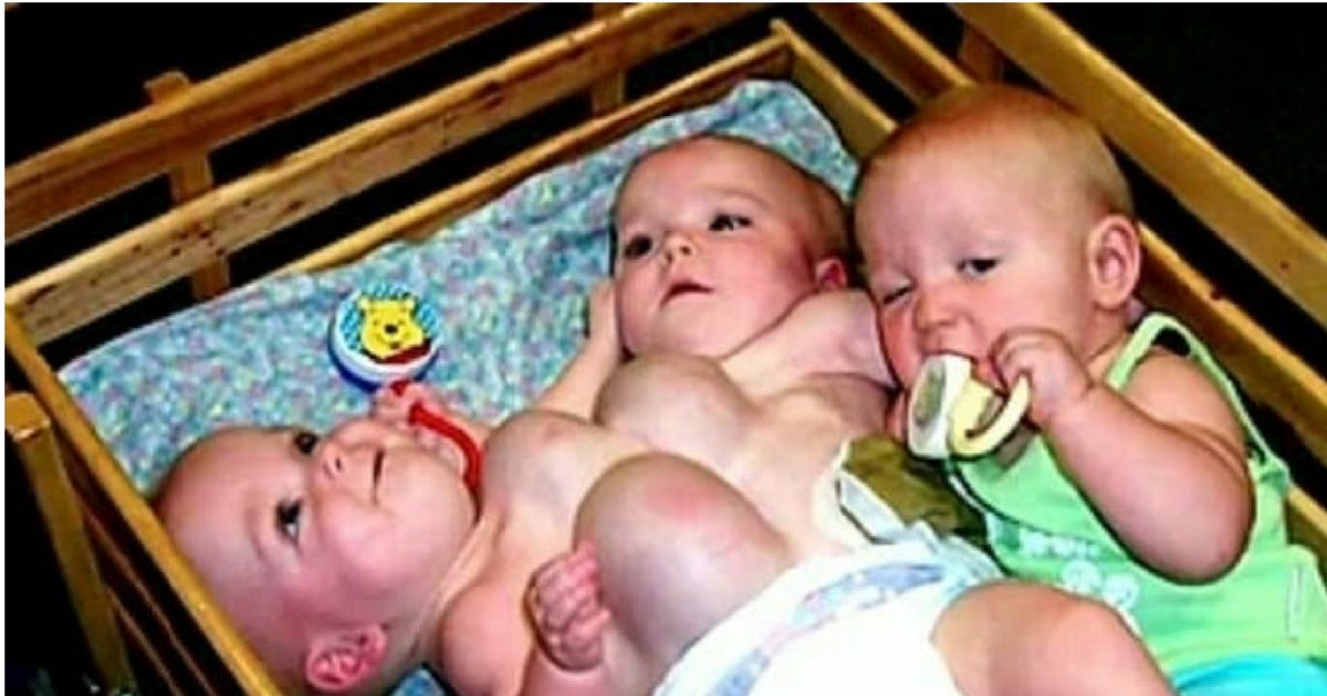 This 'unusual' set of conjoined triplets earned international fame, here's what they look like 16 years later