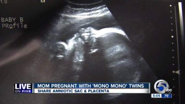 Doctor Looks Down Seconds After He Delivers Twins – What He Sees Leaves Him Stunned