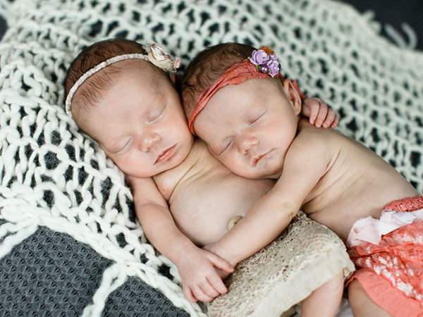 Doctor Looks Down Seconds After He Delivers Twins – What He Sees Leaves Him Stunned
