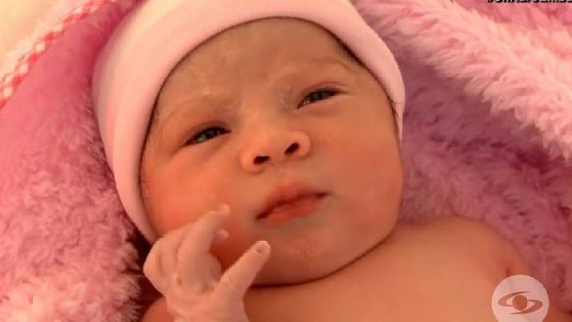 Baby Girl Is Born 'Pregnant' - Has To Have C-Section So Doctors Can ...